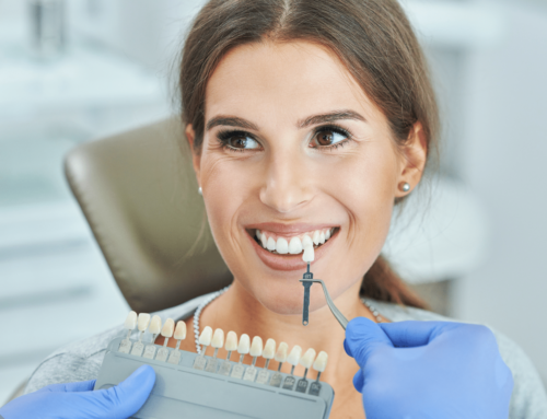 Misconceptions About Teeth Whitening: What You Need to Know